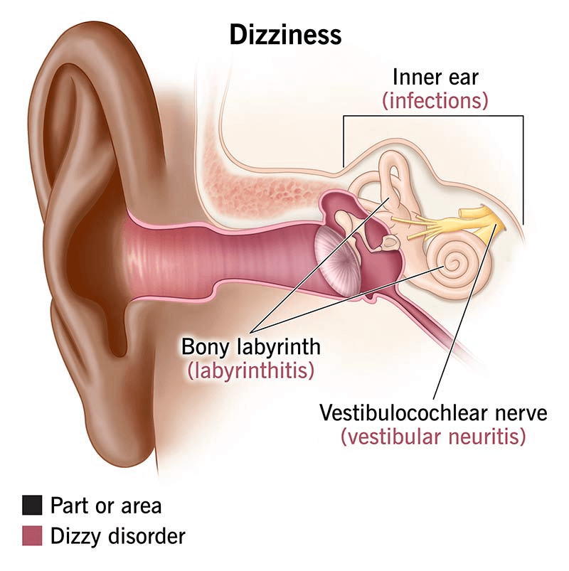 Person experiencing dizziness, trying to regain balance