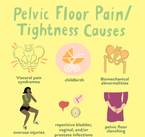 Illustration of female anatomy highlighting the pelvic floor muscles