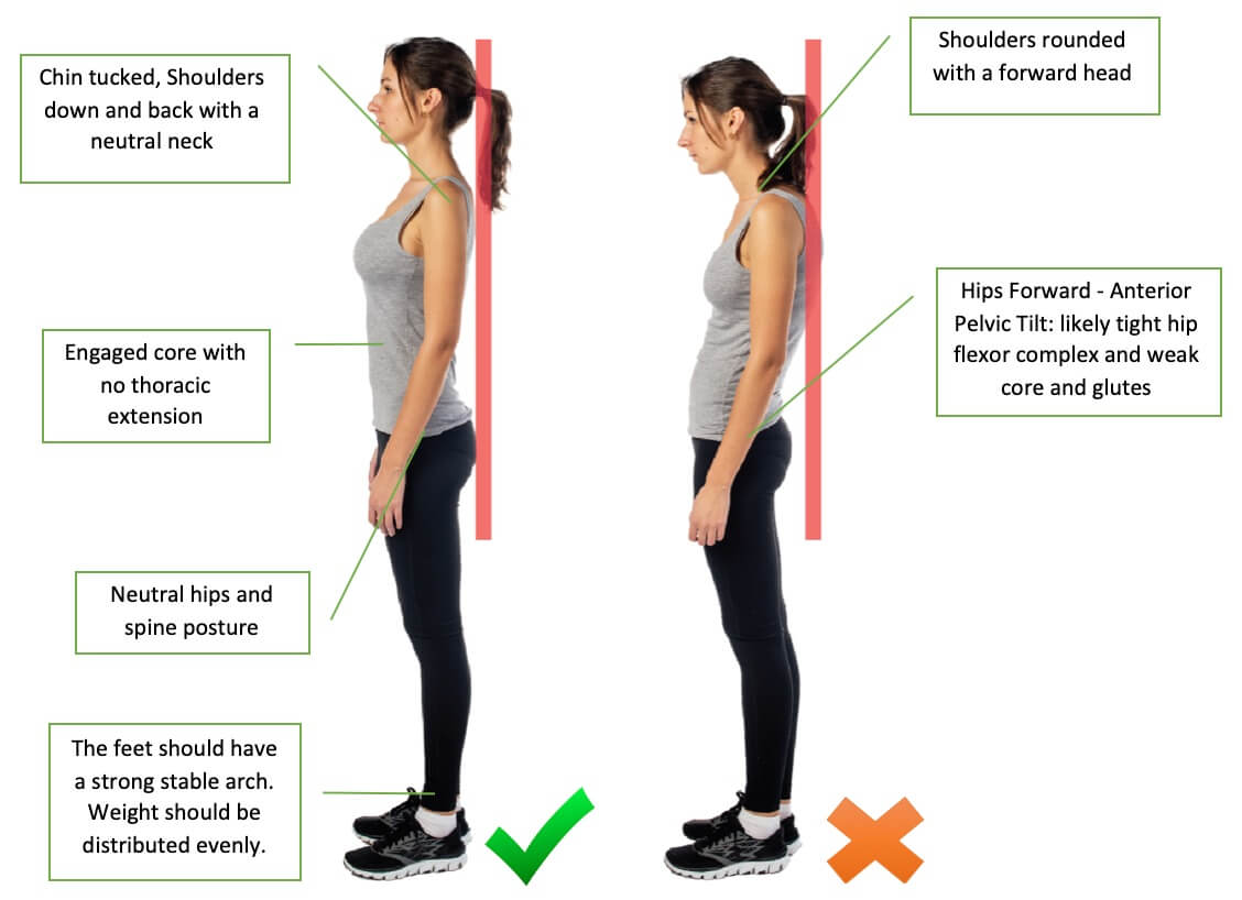 Diagram showing good vs bad posture