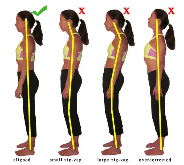 Illustrations showing signs of poor posture
