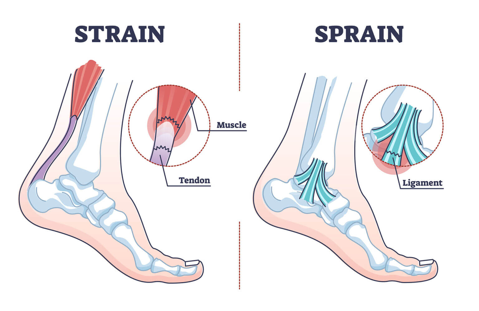 Anatomy of a knee joint